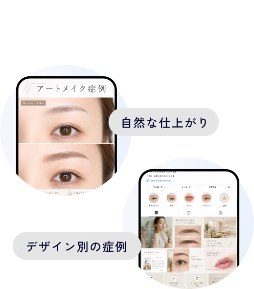症例画像とデザインを比較検討する患者行動イメージ。自然な仕上がり、デザイン別の症例