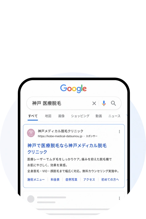広告流入や地域・部位検索で医療脱毛を発見する患者行動イメージ