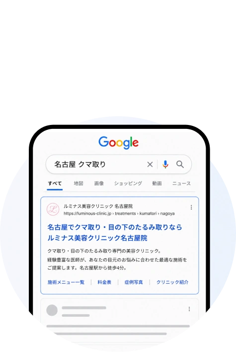 地域名検索や広告流入でクマ取り施術を発見する患者行動イメージ